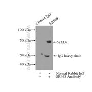SRP68 Rabbit Polyclonal Antibody (11585-1-AP)