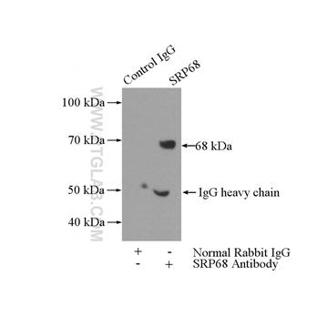 SRP68 Rabbit Polyclonal Antibody (11585-1-AP)