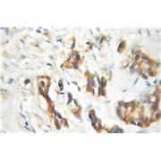 ENTPD6 Rabbit Polyclonal Antibody (11626-1-AP)