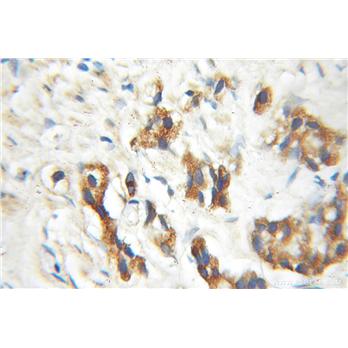 ENTPD6 Rabbit Polyclonal Antibody (11626-1-AP)