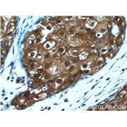 SRP54 Rabbit Polyclonal Antibody (11729-1-AP)
