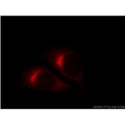 COPE Rabbit Polyclonal Antibody (11457-1-AP)