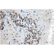 MPG Rabbit Polyclonal Antibody (11481-2-AP)
