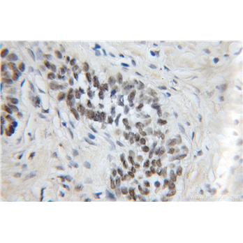 MPG Rabbit Polyclonal Antibody (11481-2-AP)