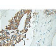 EIF2B3 Rabbit Polyclonal Antibody (11296-2-AP)
