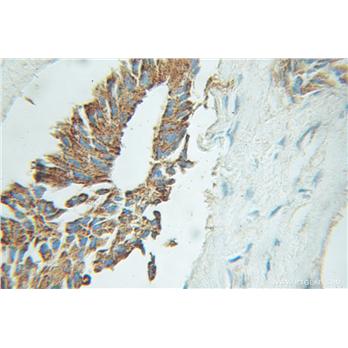 EIF2B3 Rabbit Polyclonal Antibody (11296-2-AP)