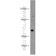 DDX39 Rabbit Polyclonal Antibody (11723-1-AP)