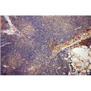 PPIB Rabbit Polyclonal Antibody (11607-1-AP)