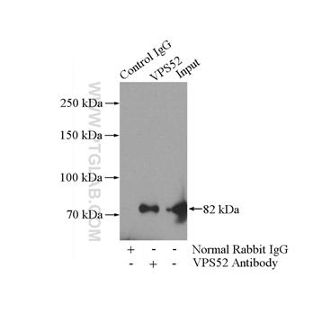 VPS52 Rabbit Polyclonal Antibody (11662-2-AP)