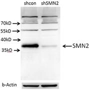 SMN2 Rabbit Polyclonal Antibody (11708-1-AP)