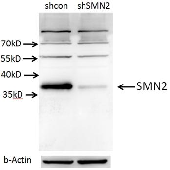 SMN2 Rabbit Polyclonal Antibody (11708-1-AP)