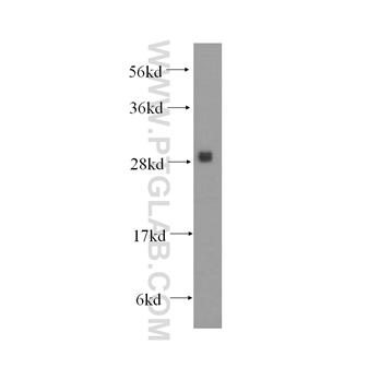 PMM1 Rabbit Polyclonal Antibody (11252-2-AP)