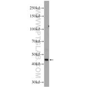 EPSTI1 Rabbit Polyclonal Antibody (11627-1-AP)