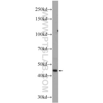 EPSTI1 Rabbit Polyclonal Antibody (11627-1-AP)