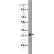 PPP1R7 Rabbit Polyclonal Antibody (11664-1-AP)