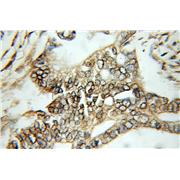 SEPT2 Rabbit Polyclonal Antibody (11397-1-AP)