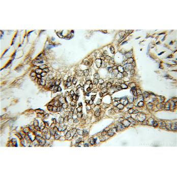 SEPT2 Rabbit Polyclonal Antibody (11397-1-AP)