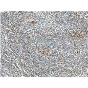 FLI1 Rabbit Polyclonal Antibody (11347-1-AP)