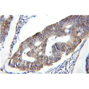 DDB1 Rabbit Polyclonal Antibody (11380-1-AP)