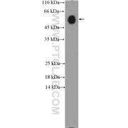 IGHA1 Rabbit Polyclonal Antibody (11449-1-AP)