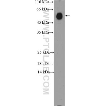 IGHA1 Rabbit Polyclonal Antibody (11449-1-AP)