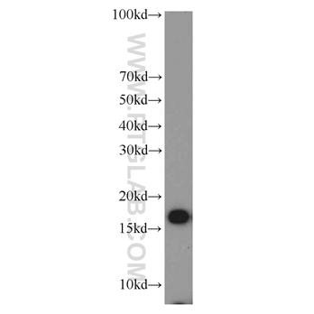 COX4I1 Rabbit Polyclonal Antibody (11242-1-AP)