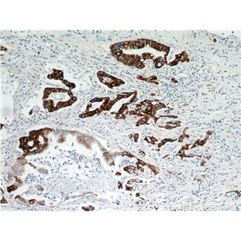 TMPRSS4 Rabbit Polyclonal Antibody (11283-1-AP)