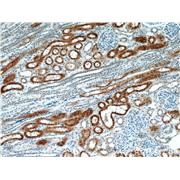 CYP4A11 Rabbit Polyclonal Antibody (11688-1-AP)