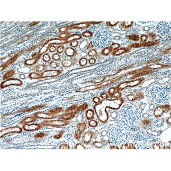CYP4A11 Rabbit Polyclonal Antibody (11688-1-AP)
