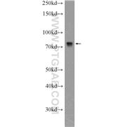 DEF6 Rabbit Polyclonal Antibody (11369-1-AP)