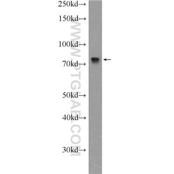 DEF6 Rabbit Polyclonal Antibody (11369-1-AP)
