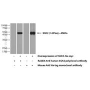 SGK2 Rabbit Polyclonal Antibody (11185-1-AP)