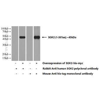 SGK2 Rabbit Polyclonal Antibody (11185-1-AP)