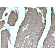 ALDOA Rabbit Polyclonal Antibody (11217-1-AP)