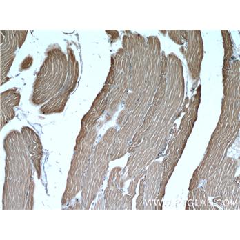 ALDOA Rabbit Polyclonal Antibody (11217-1-AP)