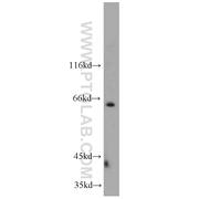 NEIL3 Rabbit Polyclonal Antibody (11621-1-AP)
