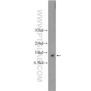 HOPX Rabbit Polyclonal Antibody (11419-1-AP)
