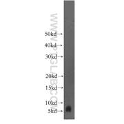 FXYD2 Rabbit Polyclonal Antibody (11198-1-AP)