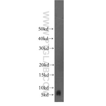 FXYD2 Rabbit Polyclonal Antibody (11198-1-AP)