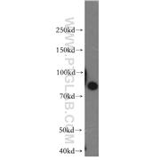 STIM1 Rabbit Polyclonal Antibody (11565-1-AP)