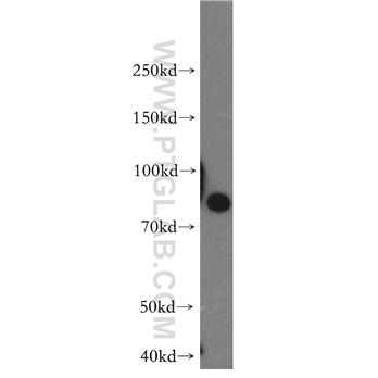 STIM1 Rabbit Polyclonal Antibody (11565-1-AP)