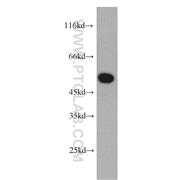 MTRF1 Rabbit Polyclonal Antibody (11581-1-AP)