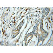 SSR4 Rabbit Polyclonal Antibody (11655-2-AP)