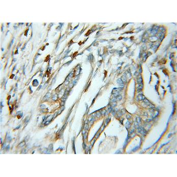 SSR4 Rabbit Polyclonal Antibody (11655-2-AP)