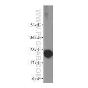 PSMB6 Rabbit Polyclonal Antibody (11684-2-AP)