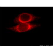 ORM2 Rabbit Polyclonal Antibody (11199-1-AP)