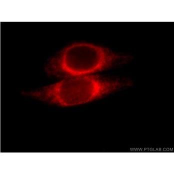 ORM2 Rabbit Polyclonal Antibody (11199-1-AP)
