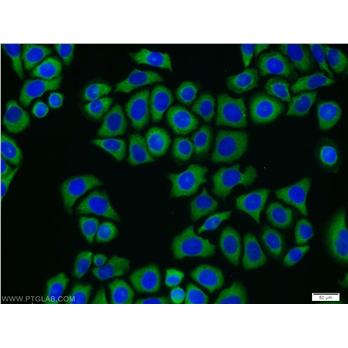 CAMKK2 Rabbit Polyclonal Antibody (11549-1-AP)