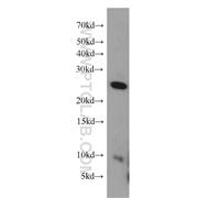 FGFR1OP2 Rabbit Polyclonal Antibody (11605-1-AP)