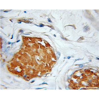 GFER Rabbit Polyclonal Antibody (11293-1-AP)